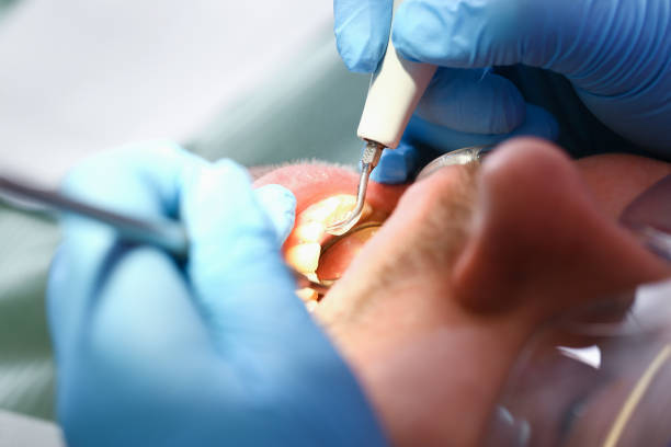 Professional Emergency Dental Service in WY